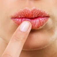 dry-lips-stay-hydrated